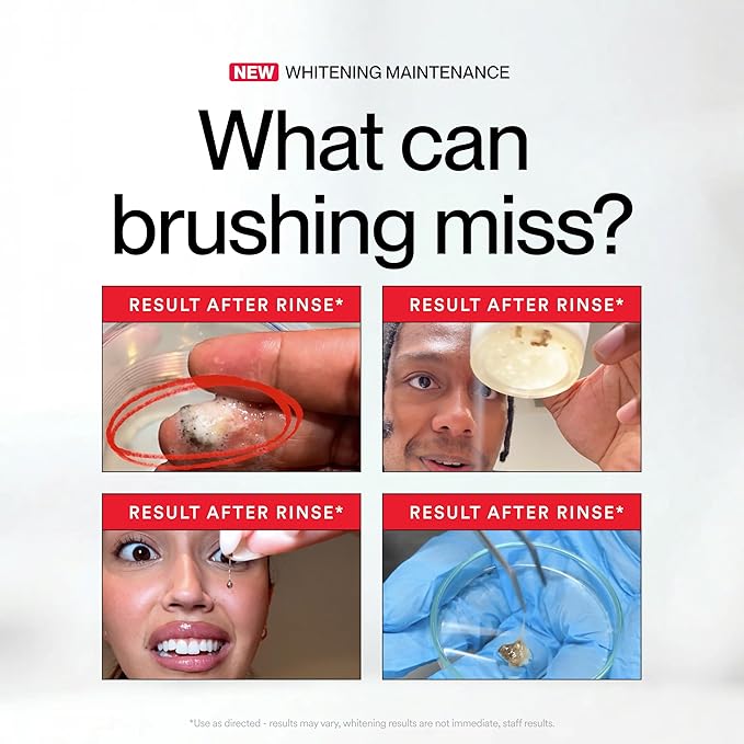 Brankson™ 🦷 Hismile iD Stain-Removing Whitening Mouthwash 237ml ✨