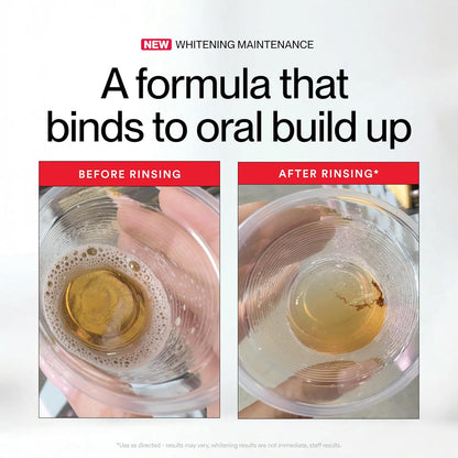 Brankson™ 🦷 Hismile iD Stain-Removing Whitening Mouthwash 237ml ✨
